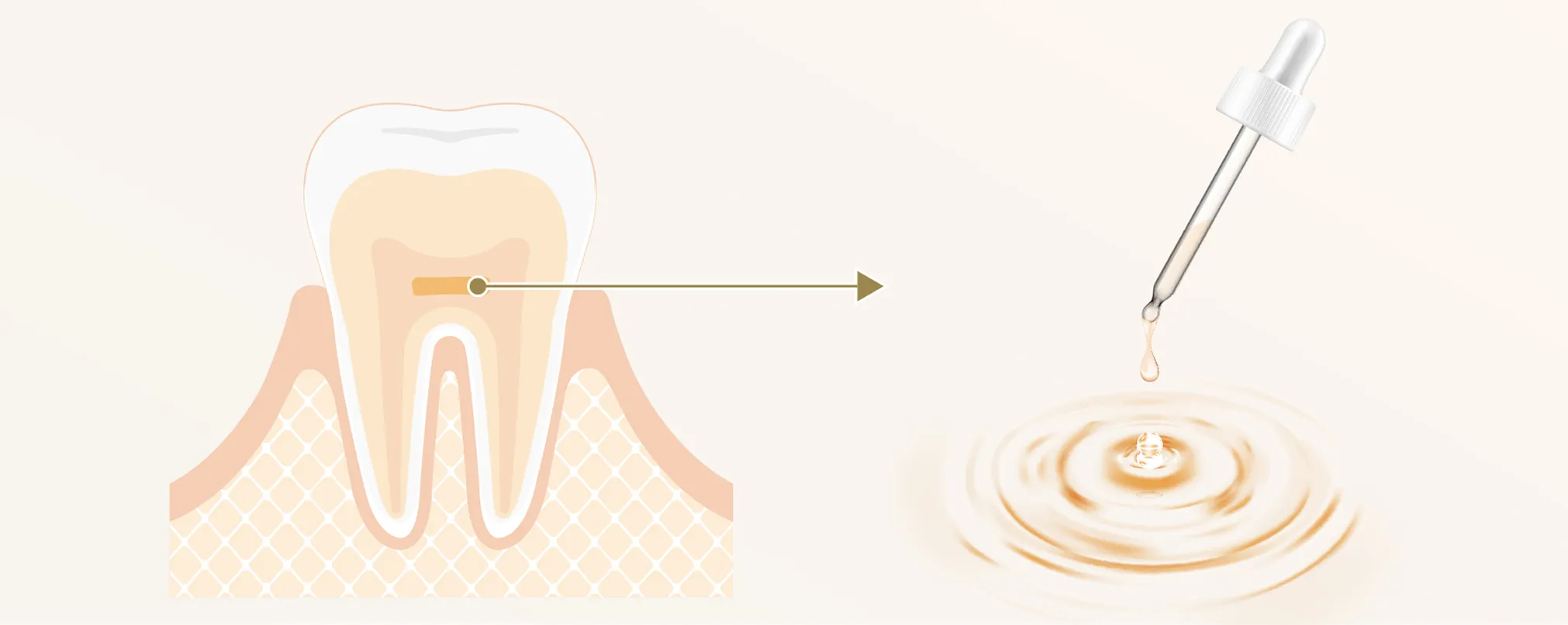乳歯の歯髄から得られる幹細胞を使用して精製されたエクソソームトリートメント液